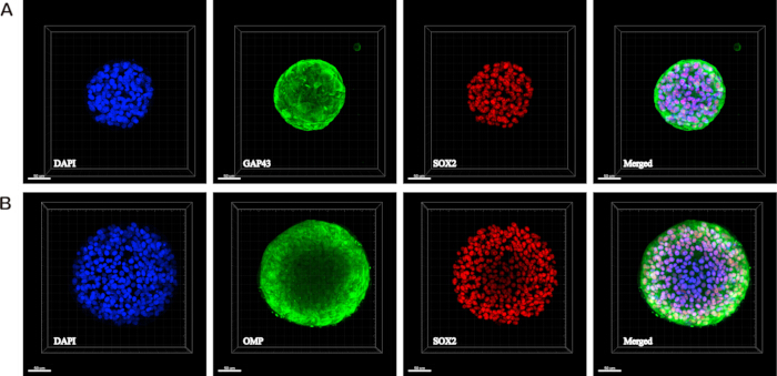 figure-results-3 Confocal microscopy of cell markers DAPI, GAP43, OMP, SOX2; fluorescent imaging results.