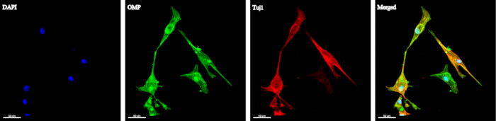 figure-results-4 Fluorescence microscopy of cells; DAPI, OMP, TuJ1 stains show nucleus and proteins; merged view.