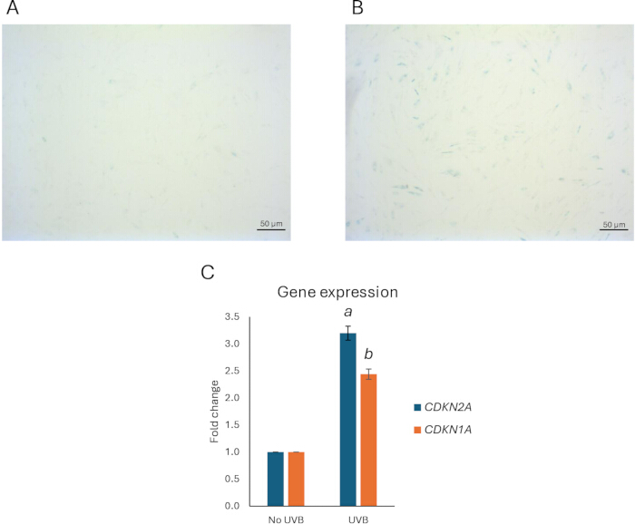 Gene expression analysis, microscopy images (A, B) of UVB impact on cells, (C) bar graph results.