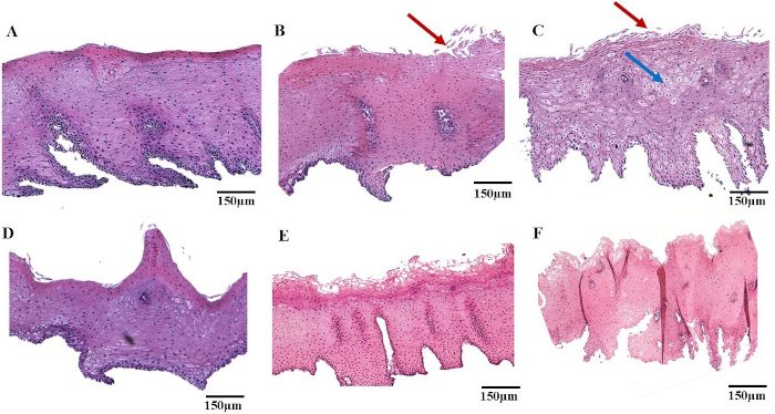 Histology: Skin tissue cross-sections, microscope image, cellular structure analysis, 150μm scale bar.