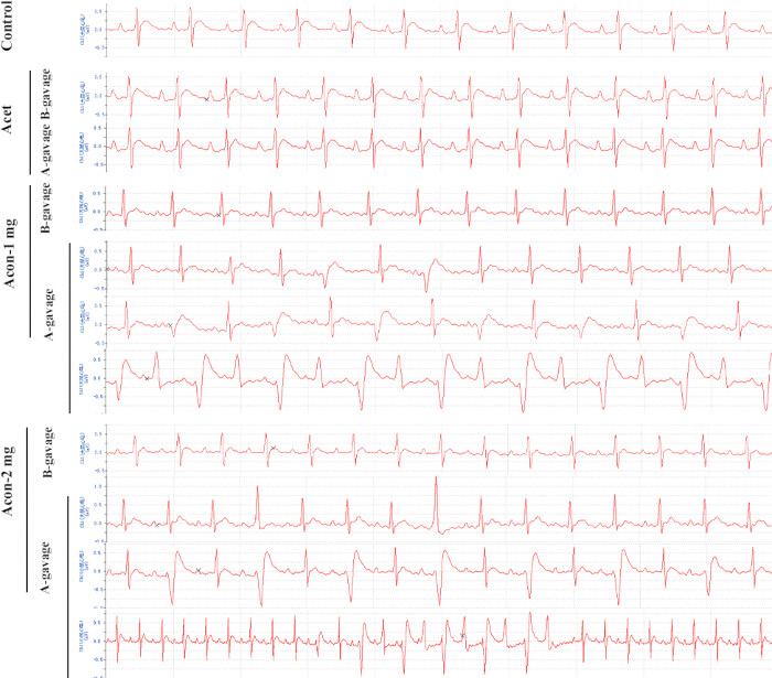 figure-results-1 ECG chart showing heart rhythm comparison under control, Acet, and Aton doses, electrophysiology data.