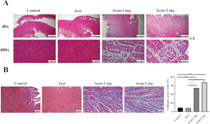 figure-results-2 Histology of liver tissue; comparative staining, control vs acetaminophen, aconitine effects.