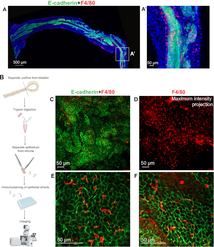 figure-results-5 E-cadherin+F4/80 immunostaining diagram; epithelial separation; microscopy; cell analysis; imaging.