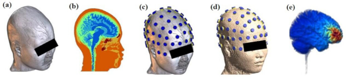 Brain imaging and EEG setup; diagram comparing 3D scalp models, MRI, electric field analysis.