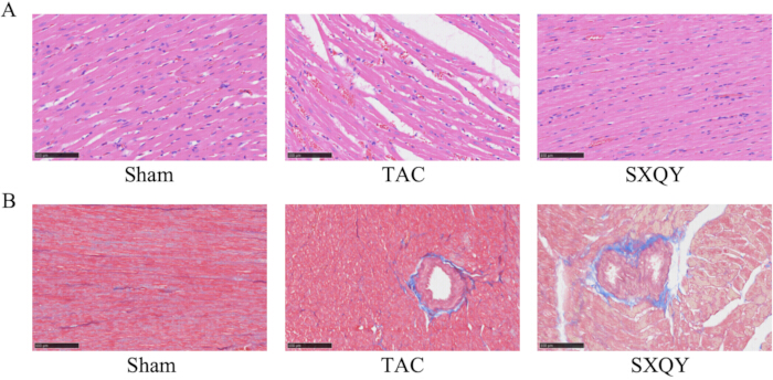 figure-results-2 组织病理学组织分析;心肌比较,假手术组、TAC组、SXQY组;显微镜图像。