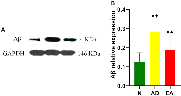 Western blot analysis and bar graph depicting Aβ and GAPDH expression for protein comparison.