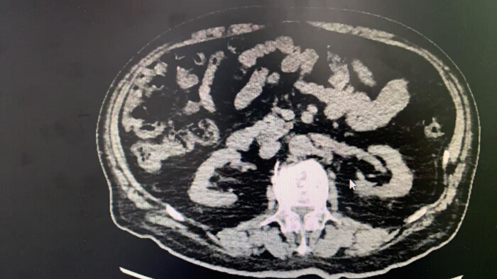 figure-results-3 Abdominal CT scan; cross-sectional imaging; diagnosis; internal organs; medical analysis.