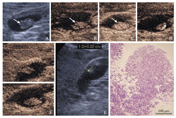 figure-results-3 Ultrasound analysis in biology, arrows pointing at specific regions, histology cross-section.