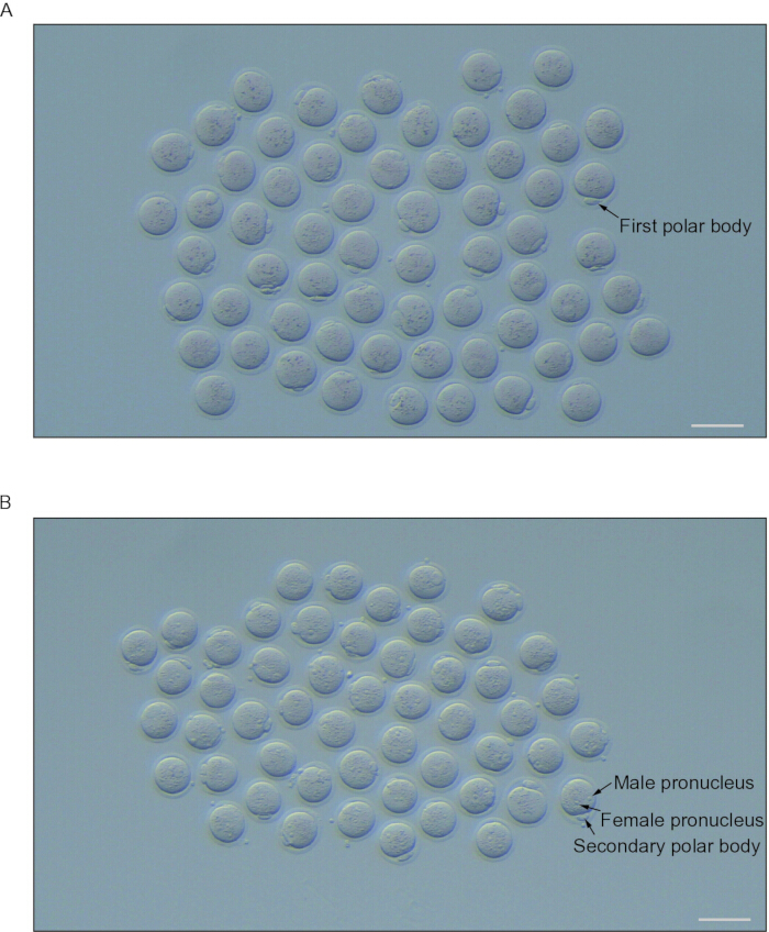 Polar body formation in zygotes, microscope image; pronucleus indicated for fertilization study.