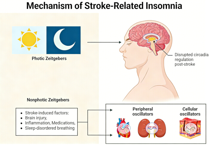 Stroke-related insomnia mechanism diagram; circadian disruption; photic nonphotic zeitgebers.