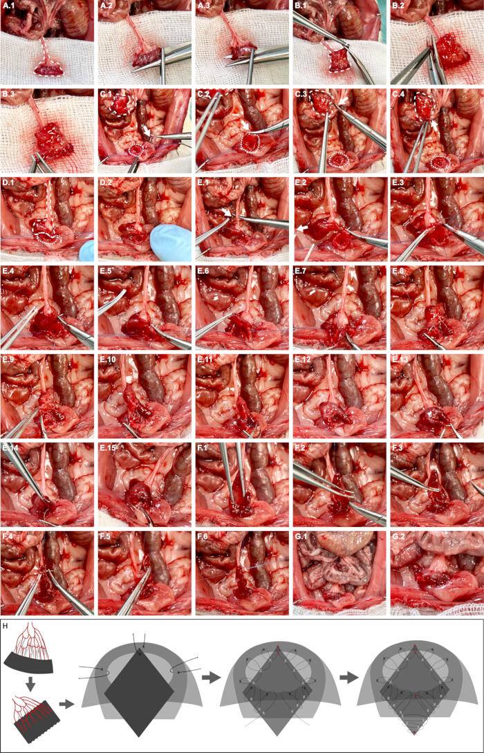 Surgical procedure sequence with tissue sampling, intestinal sections, and schematic diagram.
