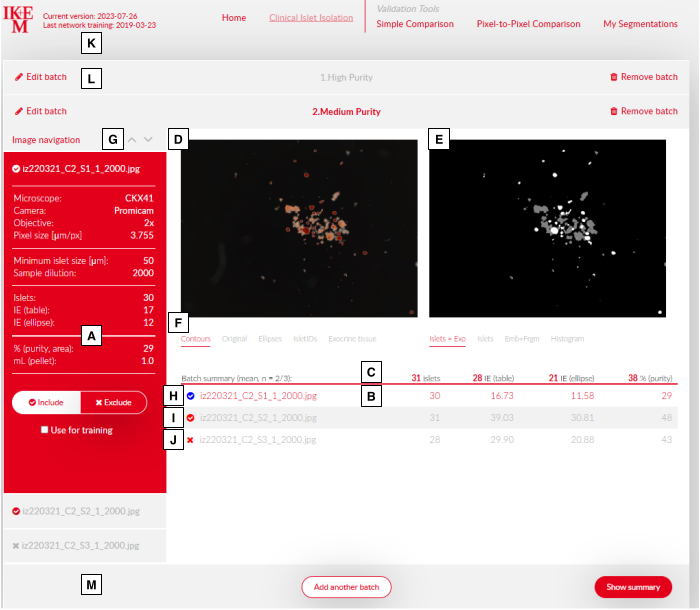 figure-protocol-1 Microscopy image analysis; comparison of islet cell purity; pixel data from CKX41 microscope; results display.