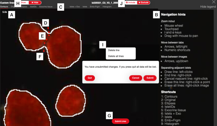 figure-protocol-2 Cell segmentation diagram with labeled regions (A-F) at 5x magnification; contour analysis setup.