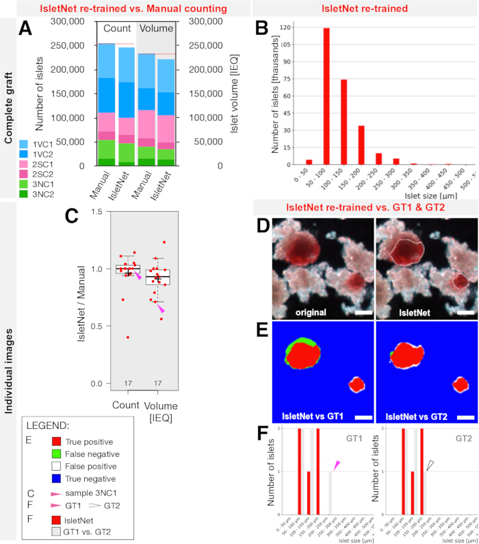 figure-results-2 Islet quantification comparison: IsletNet vs. manual; charts A, B, C; images D, E, F; accuracy analysis.