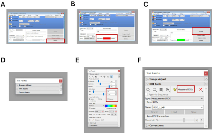 Software interface workflow, ROI measurement tool, image analysis steps, diagram.