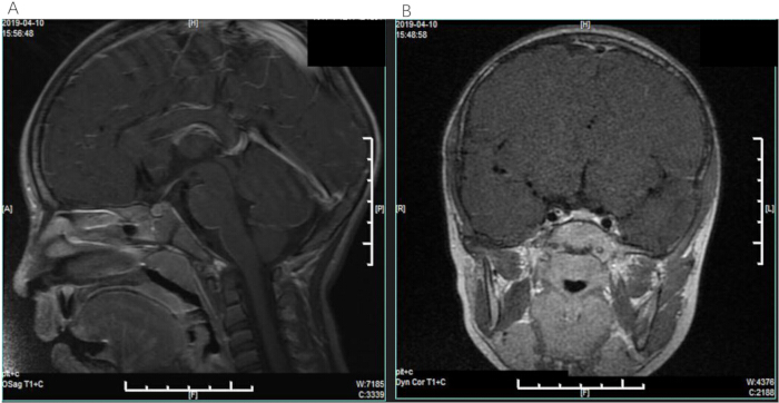 figure-introduction-3 Brain MRI scans, sagittal and coronal views, medical imaging for diagnostic analysis.