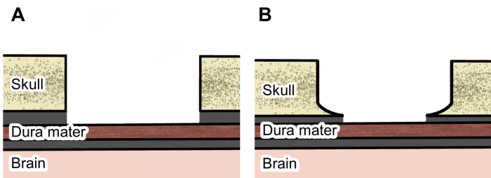 Brain protection diagram, skull and dura mater sections, comparative anatomical illustration.