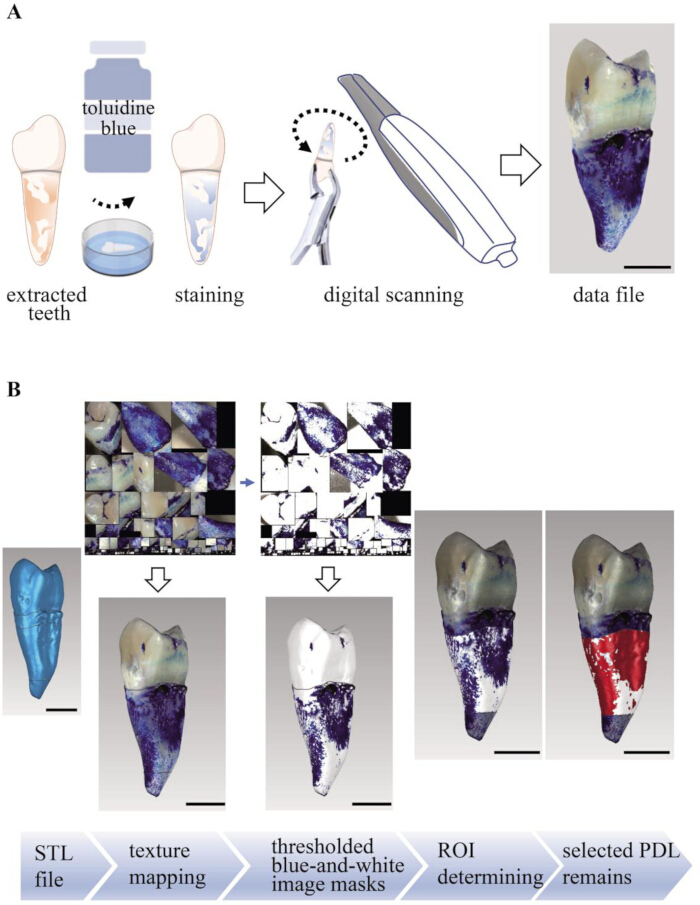 figure-results-2 Tooth staining and digital scanning process; diagrams show PDL analysis with toluidine blue.