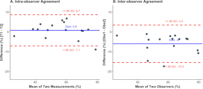 figure-results-6 Bland-Altman plots illustrating intra- and inter-observer agreement, mean bias, limits of agreement.