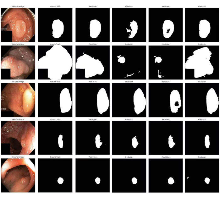 figure-results-5 Colon polyp segmentation; medical imaging analysis; original, ground truth, prediction comparisons.