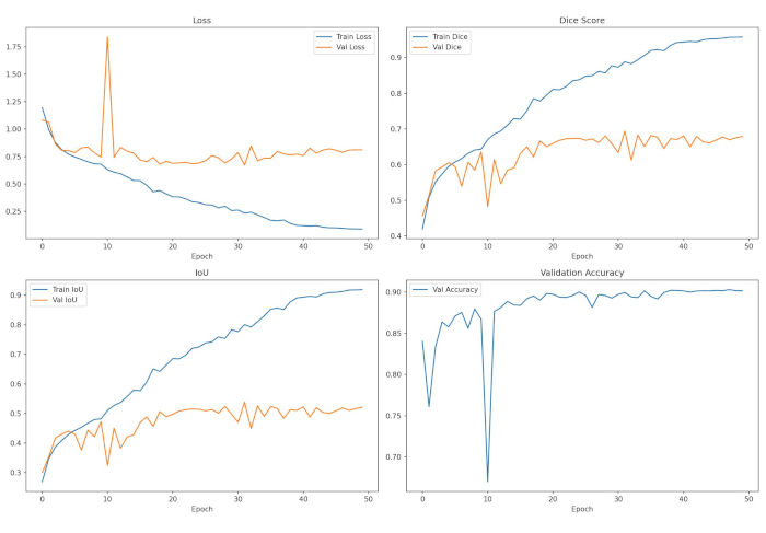 figure-results-6 Machine learning results; training vs validation; graphs of loss, IoU, Dice score, accuracy trends.