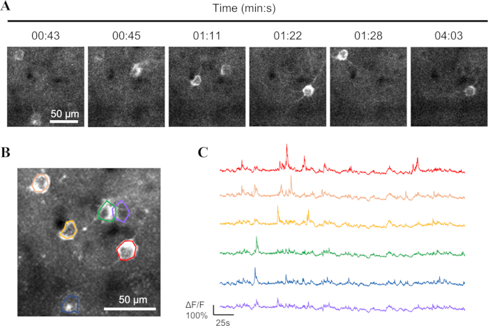 Time-lapse microscopy of cellular activity; fluorescence signal analysis; diagram with spectra results.