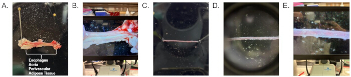 figure-results-2 Tissue dissection under microscope; esophagus, aorta, tissue layers; biological analysis setup.