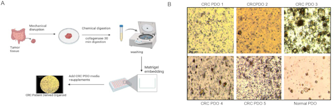 Tumor tissue preparation: mechanical, chemical digestion; patient-derived organoids; microscopy results.
