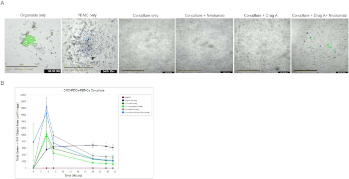 Organoid co-culture experiment; microscopy images; drug analysis and CRC-PDOs+PBMCs time-course graph.