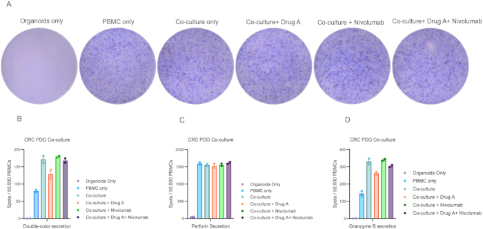 Colorectal cancer organoid co-culture experiment results; diagrams show secretion levels and effects of drugs and treatments.