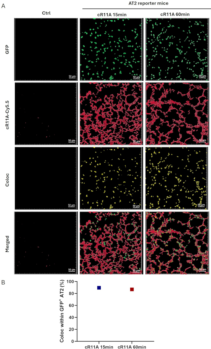 figure-results-3 Fluorescence microscopy of AT2 reporter mice with GFP, cR11A-Cy5.5 colocalization analysis.