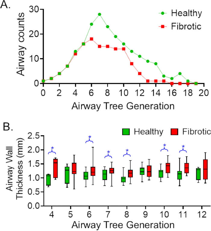 Airway generation analysis; graph, box plot comparing healthy vs fibrotic counts and thickness.