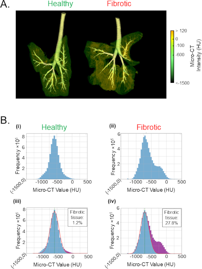 Micro-CT lung analysis, healthy vs fibrotic, image and histogram charts show tissue density differences.