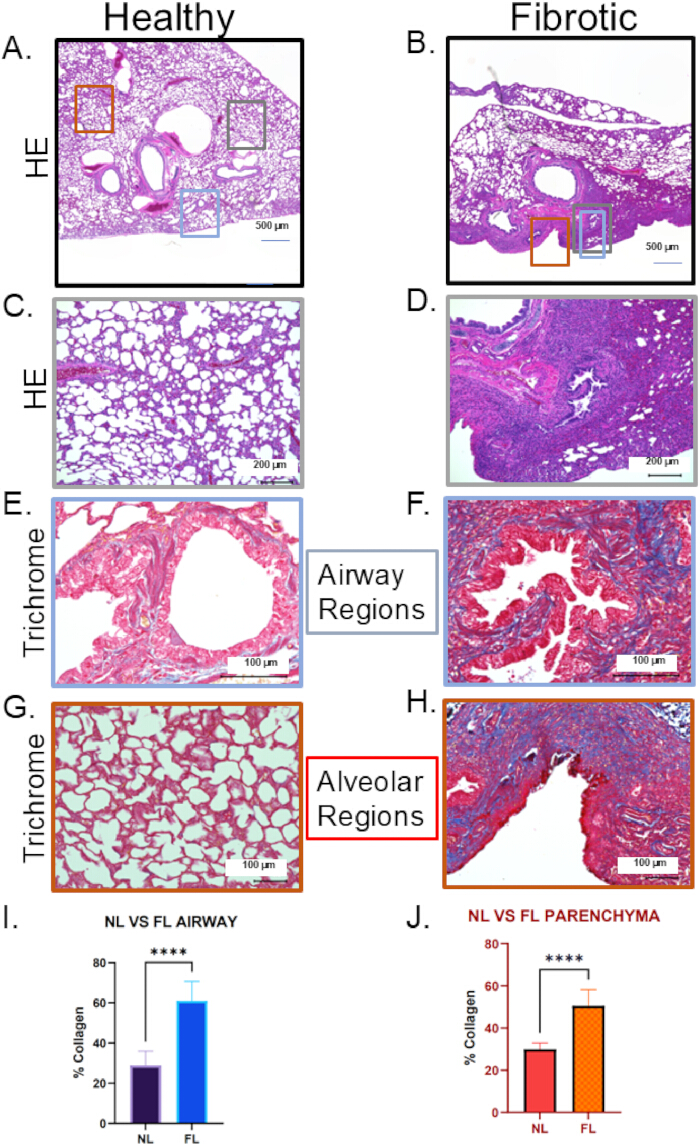 Histological analysis, healthy vs fibrotic lung. HE, Trichrome staining; airway, alveolar regions.