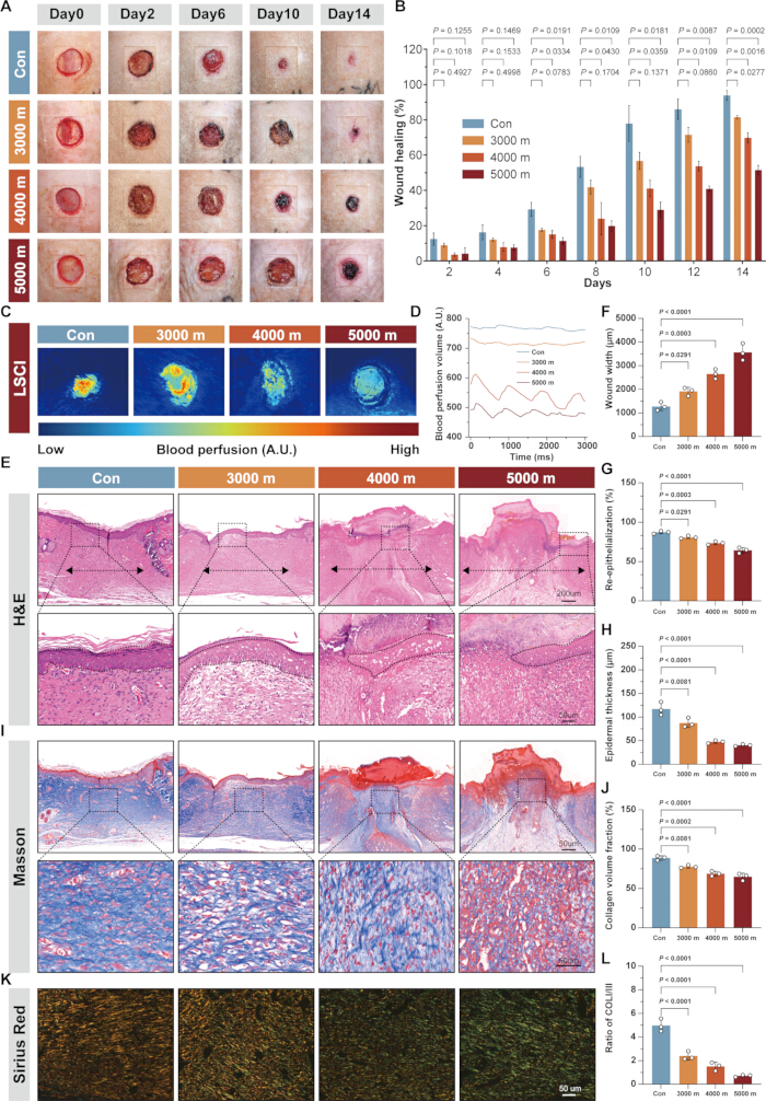 figure-results-3 Wound healing analysis, diagrams, laser speckle contrast imaging, blood perfusion, histological results.