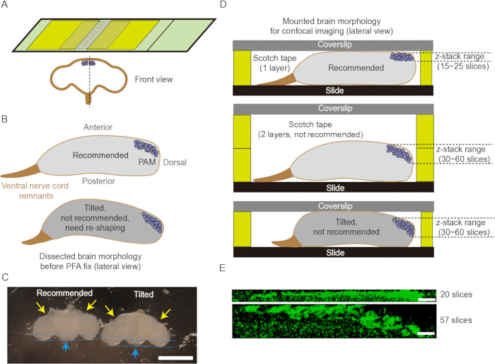 Brain dissection technique for confocal imaging: slide preparation, morphology, and slice analysis diagram.