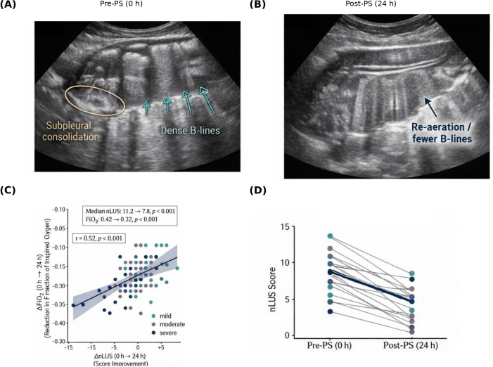 Pulmonary ultrasound showing B-lines pre/post PS, graph of nLUS score, correlation plot.