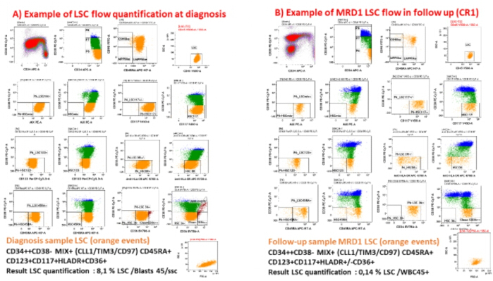 figure-results-10 LSC flow quantification diagrams; CD markers; leukemia stem cells; diagnostic and follow-up data.
