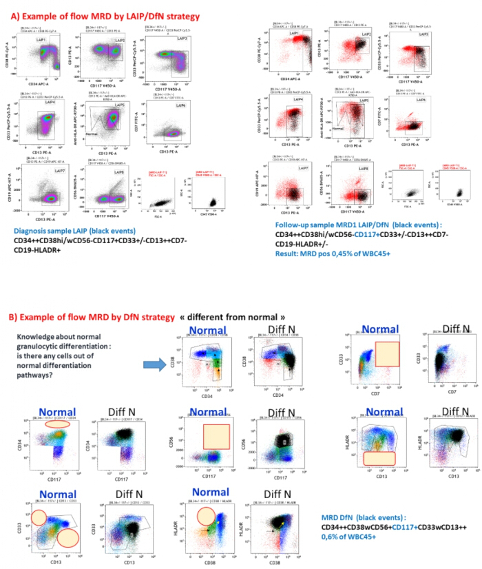 figure-results-9 Flow cytometry MRD analysis, graph showing LAIP/DfN strategy, identifying CD markers in samples.
