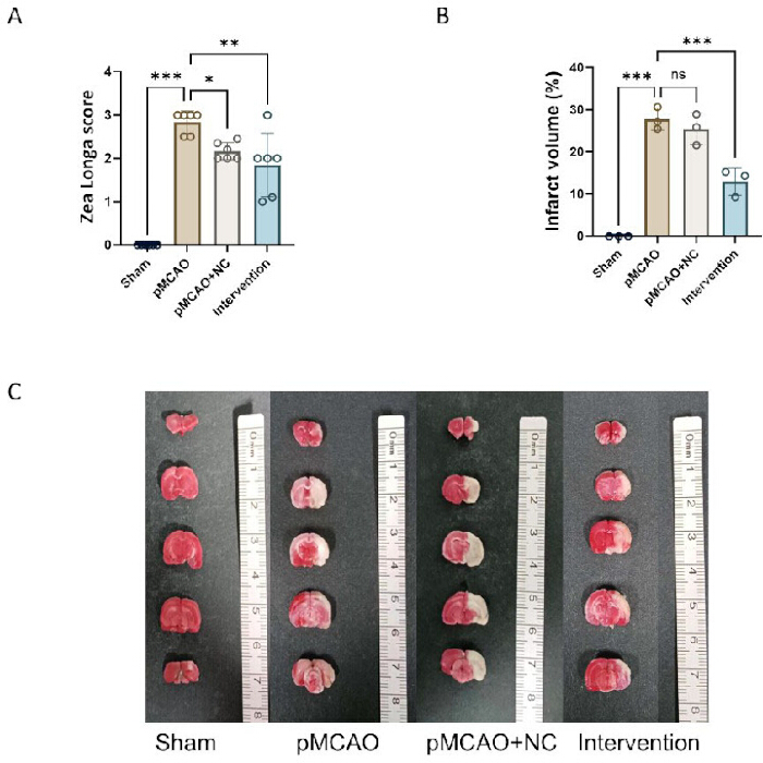 Bar graphs and brain tissue slices analyzing stroke intervention efficacy in pMCAO model experiment.