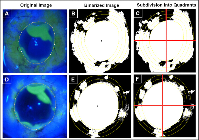 Ocular region analysis process showing original, binarized images and quadrants segmentation diagram.