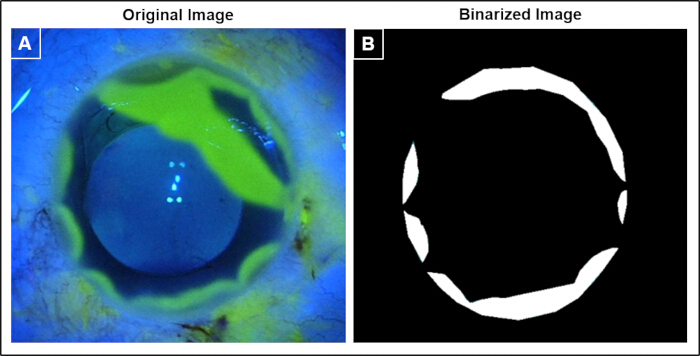 Corneal topography, image processing; diagram shows original vs. binarized fluorescein images.