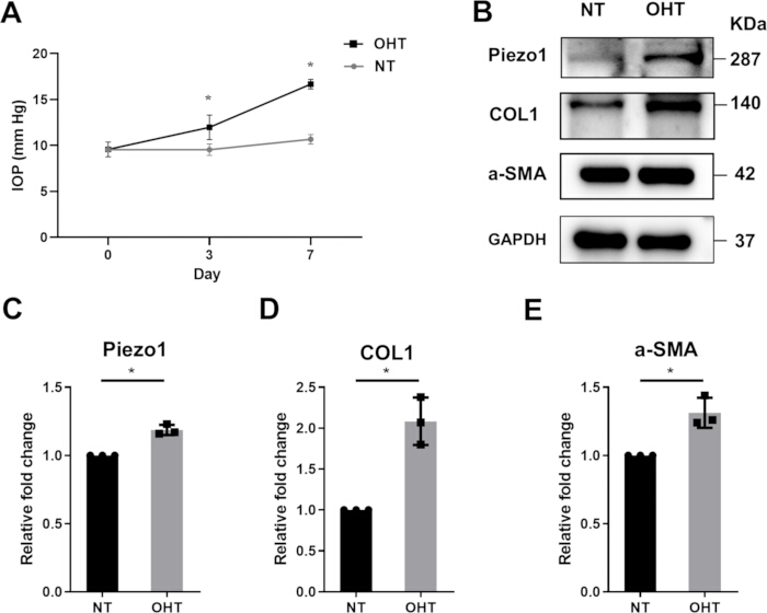 眼内压分析、蛋白表达；图表、Western blot；Piezo1、COL1、α-SMA。