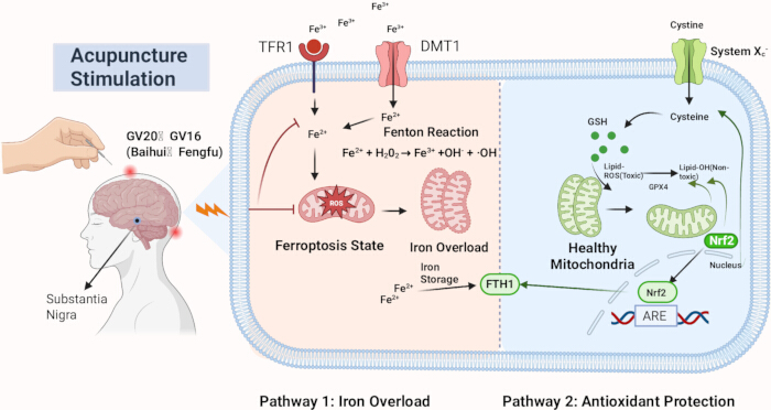 Acupuncture stimulation diagram, iron overload vs. antioxidant protection, ferroptosis, mitochondria.