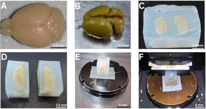 figure-results-1 Mouse brain tissue dissection and embedding process; wax block microtomy for histological analysis.