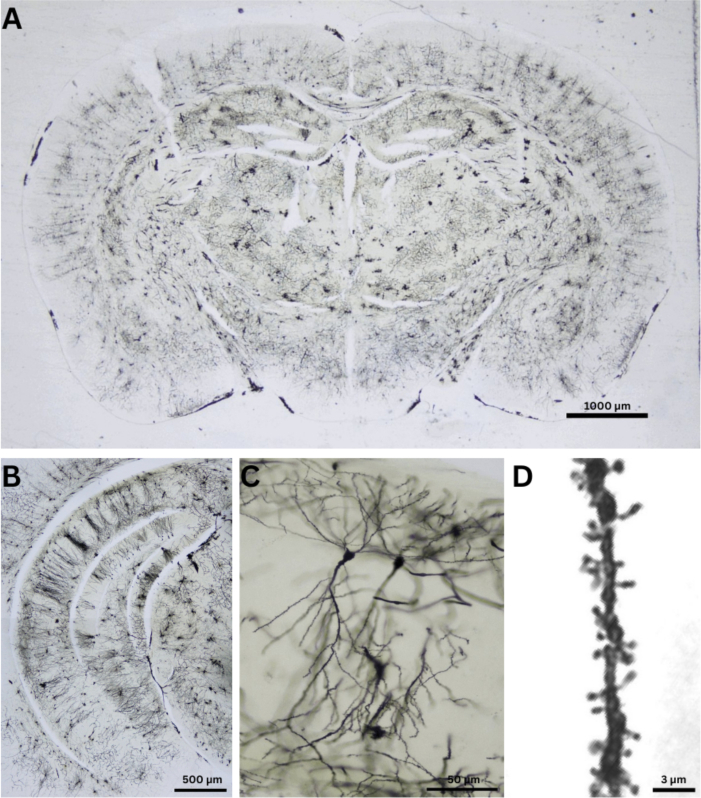 figure-results-2 Microscopy images of brain tissue structure; neuron dendrites detail magnified; histological analysis.