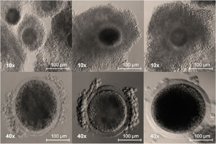 Microscope image, cell structures at 10x and 40x magnification, microscopic examination, biological study.