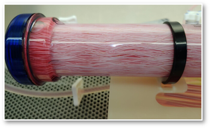Capillary flow, dialysis system, fibers, experimental setup, fluid filtration, laboratory study.