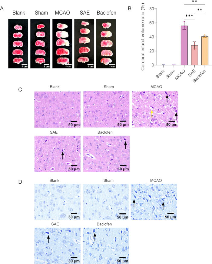 figure-results-3 Brain injury study; panel A shows cerebral infarct slices; B, infarct ratio graph; C-D, histology images.