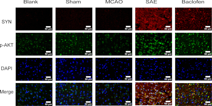 figure-results-6 Fluorescence microscopy results; SYN, p-AKT, DAPI staining; brain tissue analysis; MCAO, SAE, Baclofen.